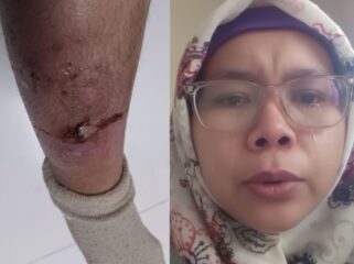 Lela Safitri menangis menahan sakitn di betisnya
