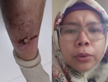 Lela Safitri menangis menahan sakitn di betisnya