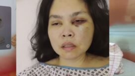 PMI Agrabinta Cianjur Mengalami Kekerasan Fisik di Dubai