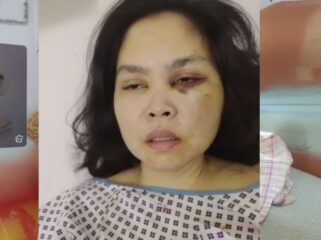 PMI Agrabinta Cianjur Mengalami Kekerasan Fisik di Dubai