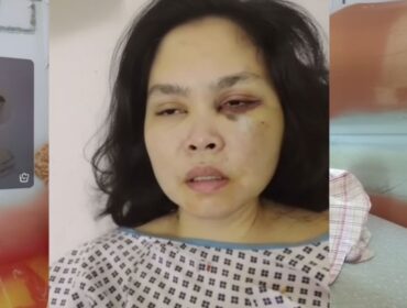 PMI Agrabinta Cianjur Mengalami Kekerasan Fisik di Dubai