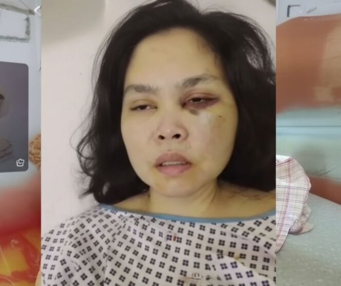 
					PMI Agrabinta Cianjur Mengalami Kekerasan Fisik di Dubai