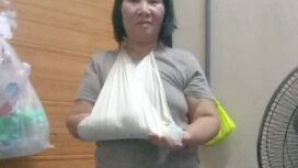 Carsinih digigit anjing