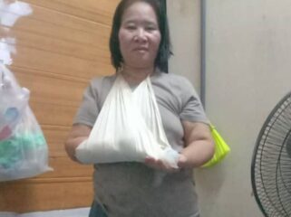 Carsinih digigit anjing