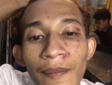 Ibu Ijah Nurjanah menunjukkan foto anaknya yang terjebak di Kamboja.