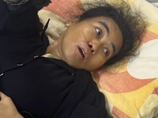 Uun Uneti alami pendarahan akibat darah tinggi