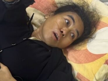 Uun Uneti alami pendarahan akibat darah tinggi