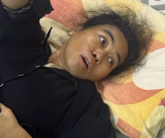 
					Uun Uneti alami pendarahan akibat darah tinggi